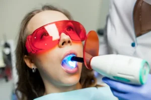 Cavity Removal with Lasers: Is It Better Than Drilling?